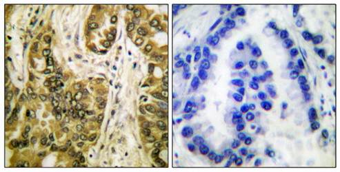 Galectin 3 Antibody