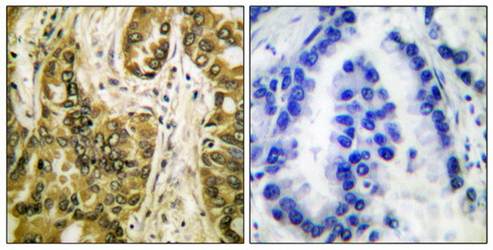 Galectin 3 antibody