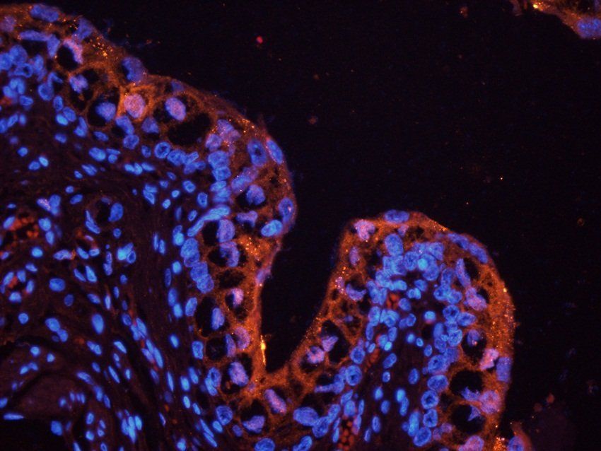 Galectin 3 antibody