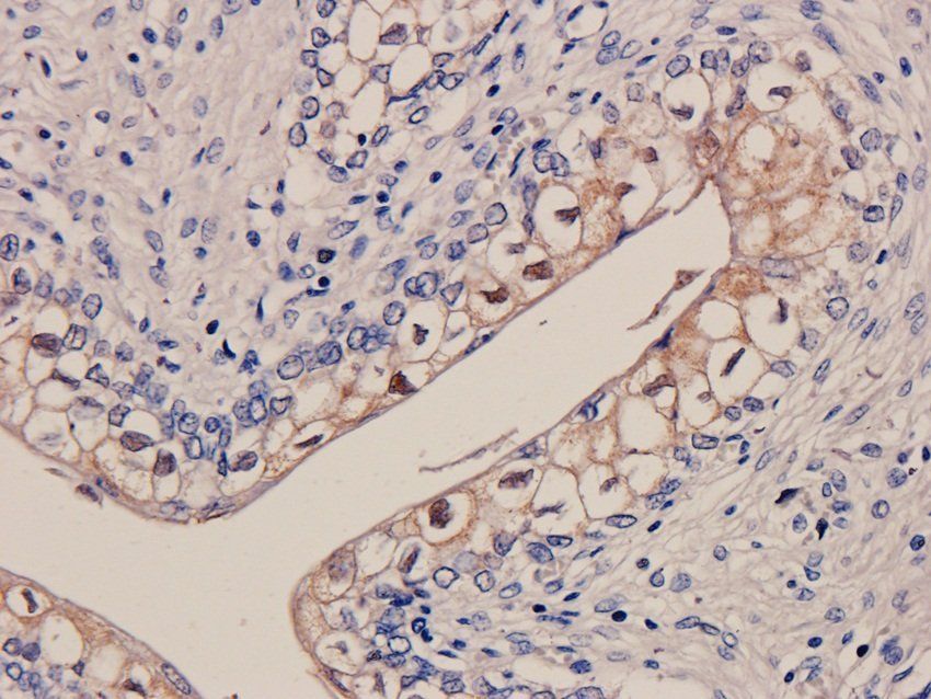 Galectin 3 antibody