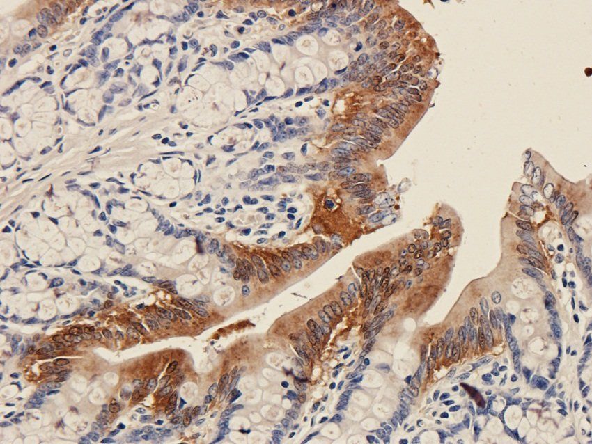 Galectin 3 antibody