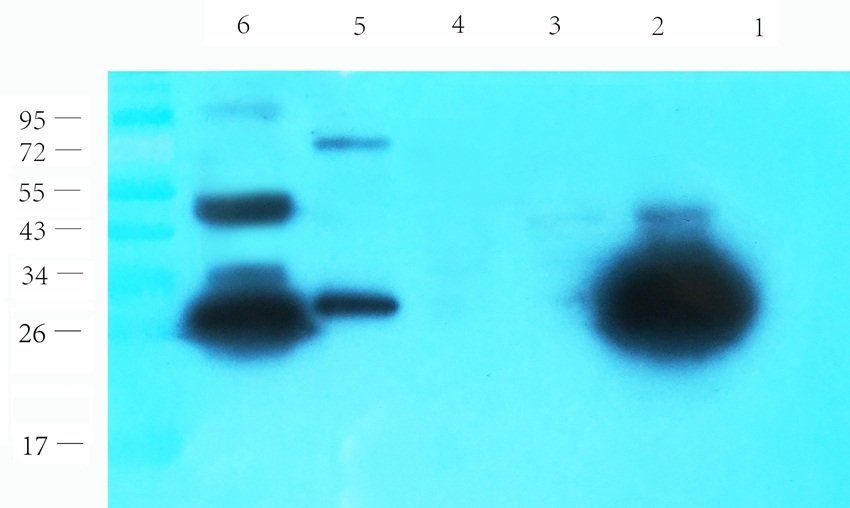 Galectin 3 antibody