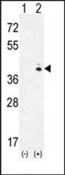 GALK1 antibody
