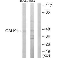 GALK1 Antibody