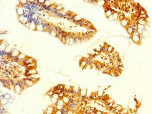 GALK2 Antibody