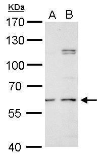 galactosamine (N-acetyl)-6-sulfatase Antibody