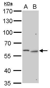 galactosamine (N-acetyl)-6-sulfatase Antibody