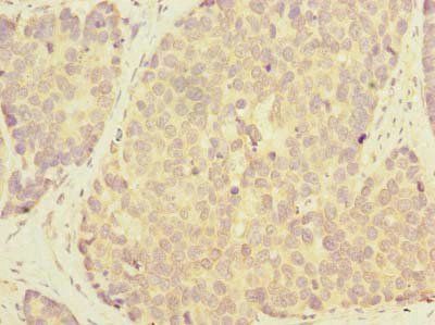 GALNT12 Antibody