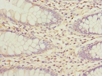 GALNT2 Antibody