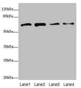 GALNT2 antibody