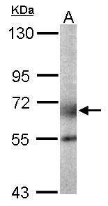 polypeptide N-acetylgalactosaminyltransferase 2 Antibody