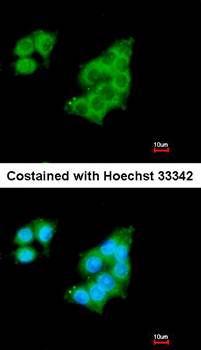 GALNT2 antibody