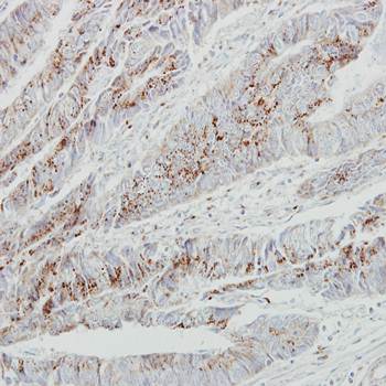 GALNT2 antibody