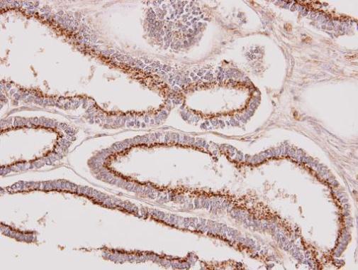 GALNT7 antibody [N1C2]