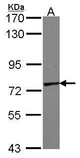 GALNT7 antibody