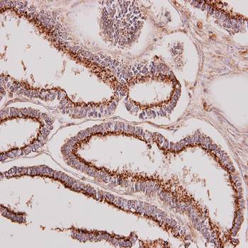 polypeptide N-acetylgalactosaminyltransferase 7 antibody