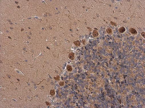 GALR2 antibody [C1C2], Internal