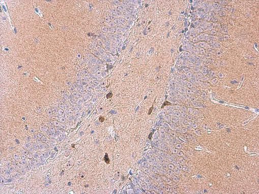 GALR2 antibody [C1C2], Internal