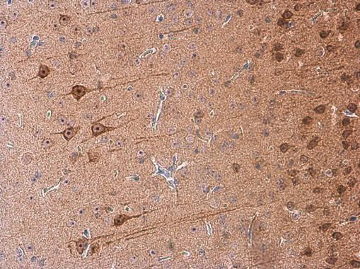 GALR2 antibody [C1C2], Internal