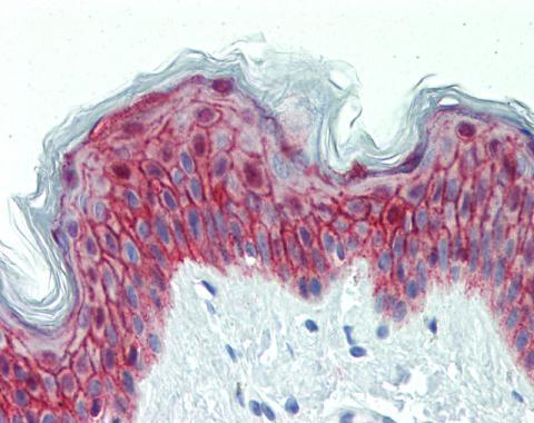 GALR2 antibody