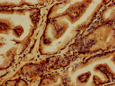 GABARAPL2 Antibody