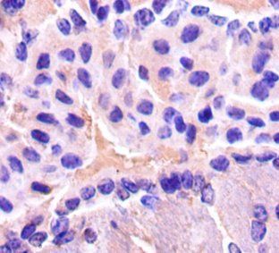 ENO2 Antibody