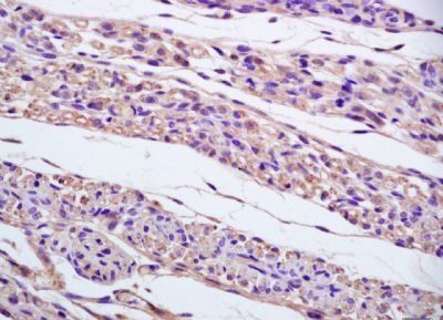 Gamma tubulin Rabbit Polyclonal Antibody