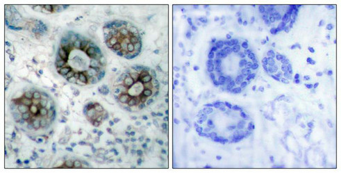 GAP43 (Ab-41) Antibody