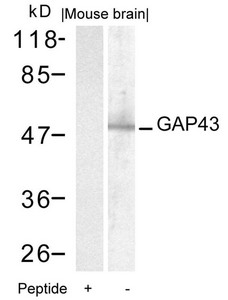 GAP43 (Ab-41) Antibody