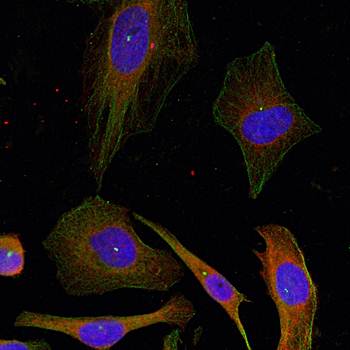 GAP43 (Ab-41) Antibody