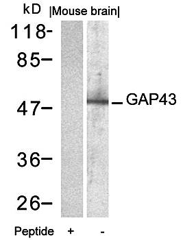 GAP43 (Ab-41) Antibody