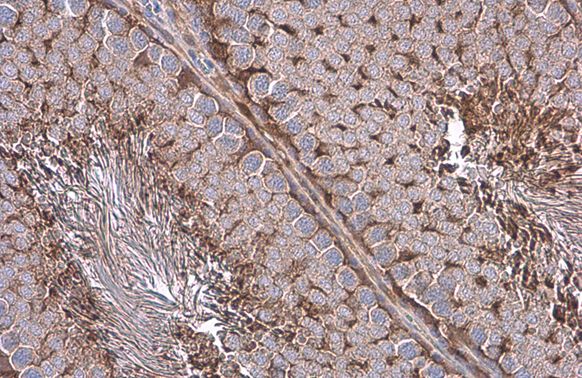 glyceraldehyde-3-phosphate dehydrogenase Antibody