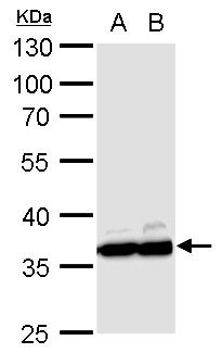 glyceraldehyde-3-phosphate dehydrogenase Antibody