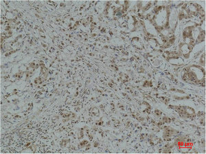 GAPDH Antibody
