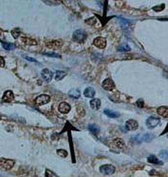 GAPDH Rabbit Polyclonal Antibody