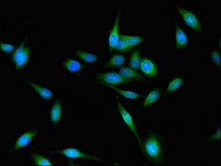 GAREM1 Antibody