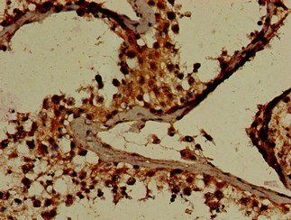 GARS Antibody