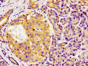 GAS1 Antibody