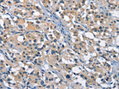 GAS2 Antibody