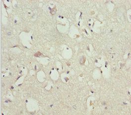 GAS2L1 Antibody