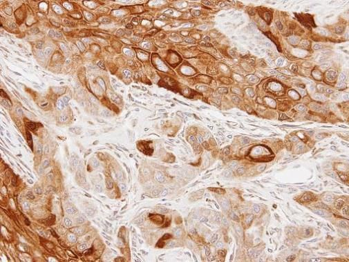 GAS2L1 antibody