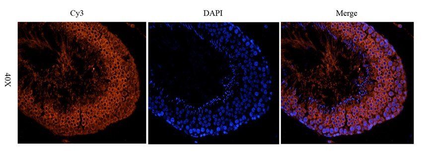 GAS6 antibody