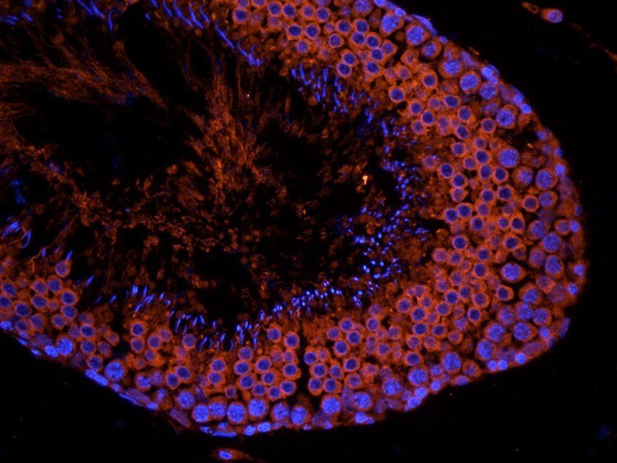 GAS6 antibody