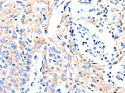 GAS6 Antibody