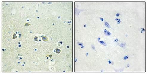 GAS6 Antibody