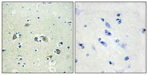 GAS6 antibody