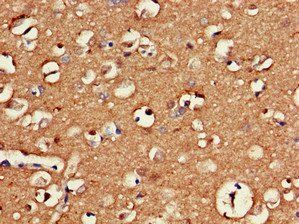GAS7 Antibody