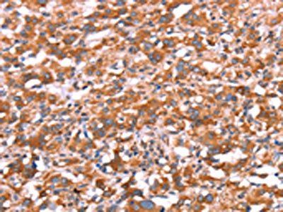 GAS8 Antibody
