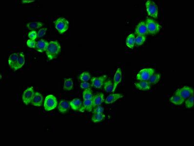 Gastrin Receptor antibody