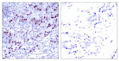 GATA1 (Ab-142) Antibody